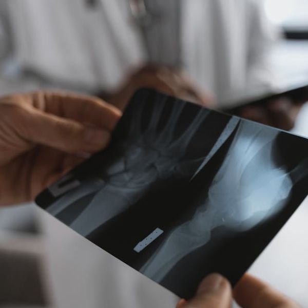 Persona observando una radiografía médica